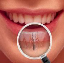 AMY Implants dentists are highly-skilled and knowledgeable, which is the key to solve all customers’ problems.