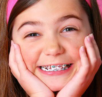 What’s the best age for Braces?