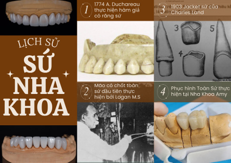 The History of Dental Porcelain